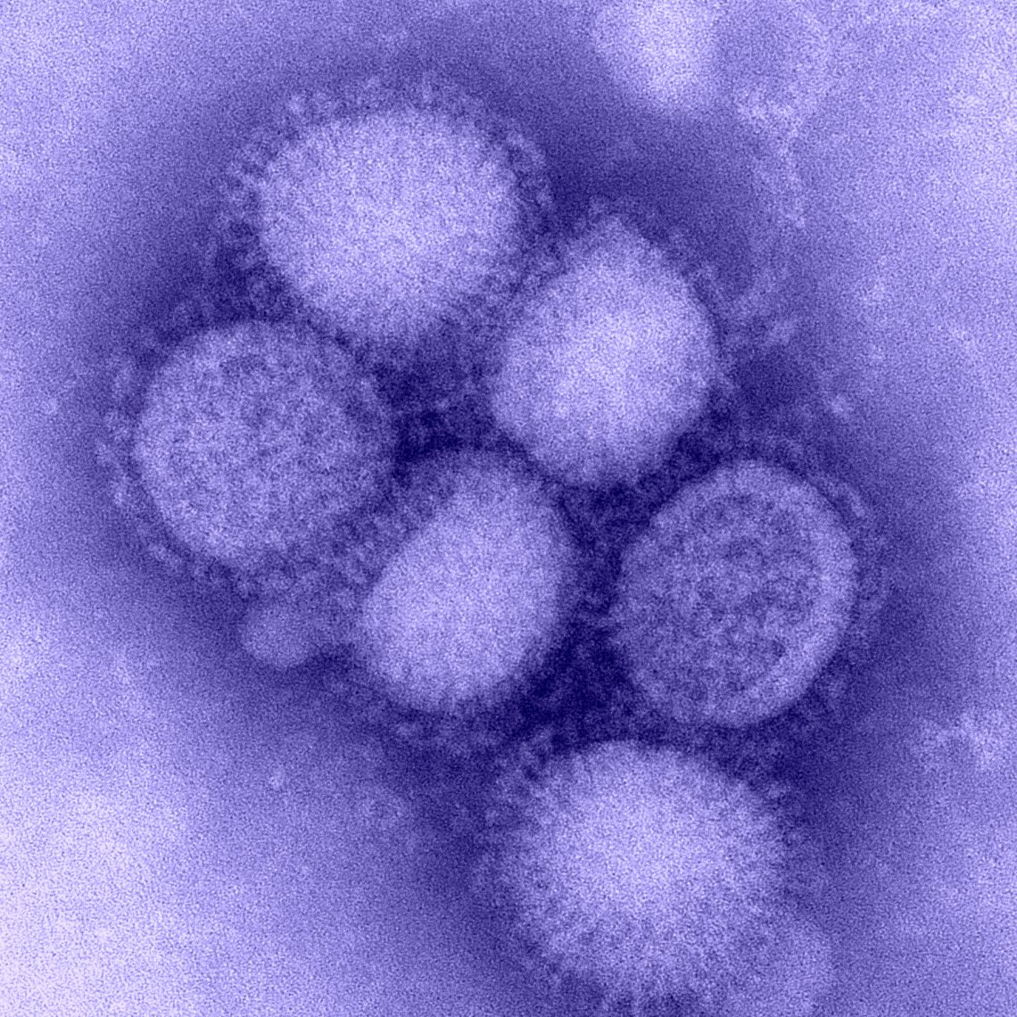 Información Sanitaria Gripe A H1N1