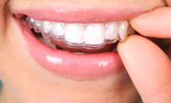 Ortodoncia - Servicio de Odontología