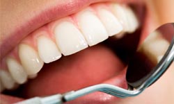 Periodoncia - Servicio de Odontología